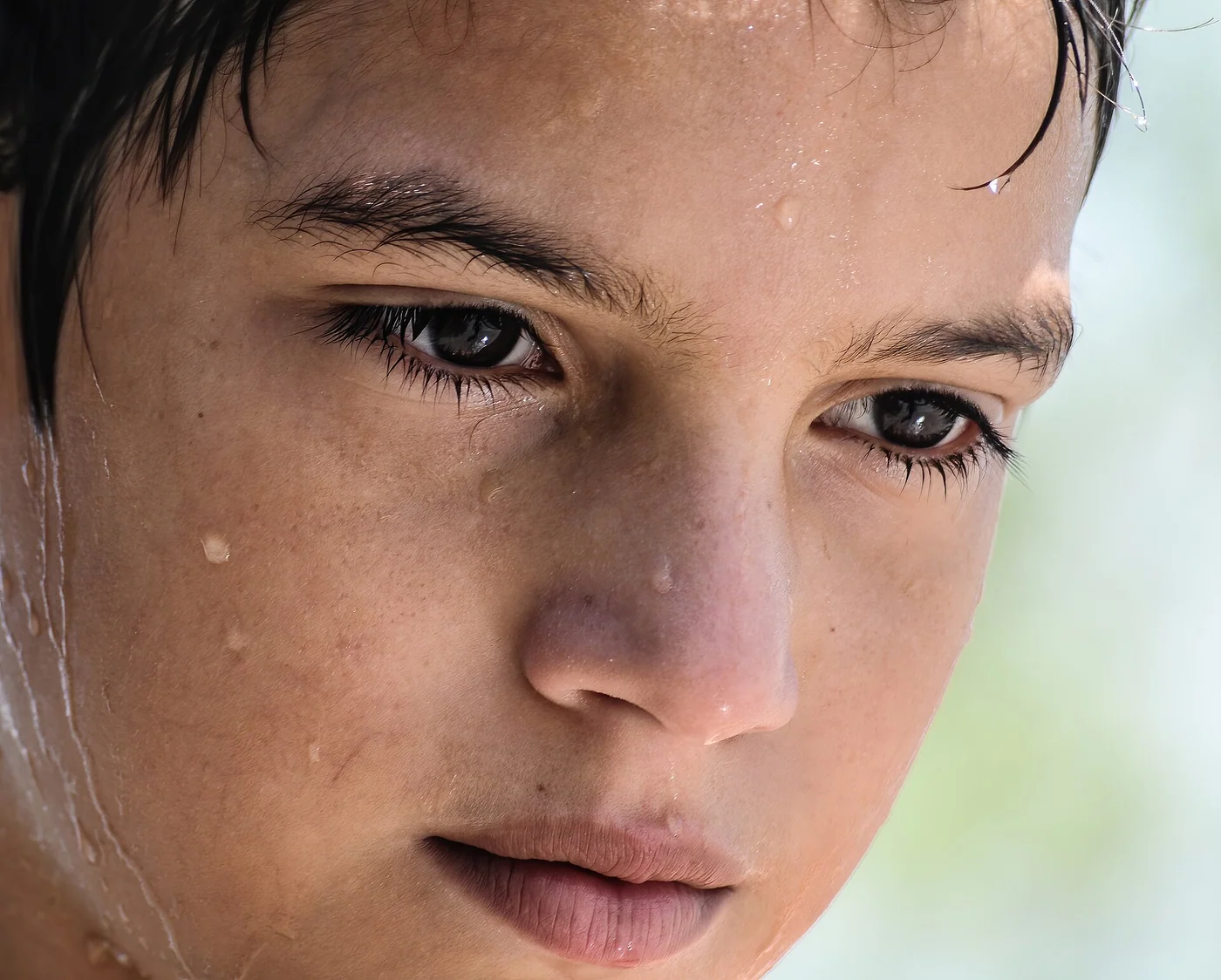 A 9-year-old boy's face, Margarita Island , Venezuela. [ 1 ]